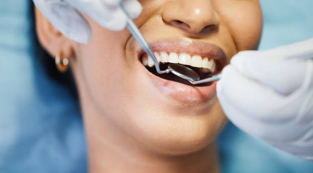 Dentist for Dental Trauma in NH