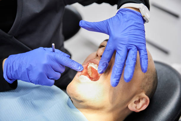 Best Chipped Tooth Repair Near Me  in Keene, NH